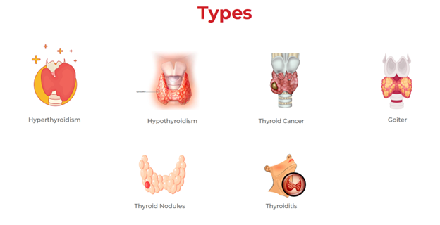 Understanding Thyroid Disease: Causes, Symptoms, and Treatment