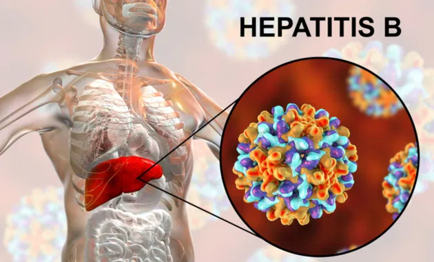 Understanding Hepatitis B: What You Need to Know