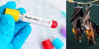 Nipah Virus Infection: Causes, Symptoms, Transmission, Prevention, and Treatment